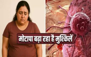 Cancer Alert: मोटापा और तनाव बना रहे बीमारी की वजह, पुरुषों में ओरल- महिलाओं में ब्रेस्ट कैंसर बढ़ा