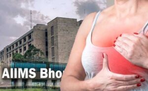 स्टेज-4 ब्रेस्ट कैंसर में नई दवाओं से बढ़ी उम्मीद, एम्स में मरीजों के इलाज के बेहतर विकल्प