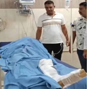 कुरुक्षेत्र में लूट के आरोपी से पुलिस की मुठभेड़, टांग में गोली लगने से घायल