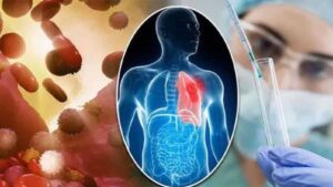 Cancer Treatment: कैंसर के इलाज में आएगी तेजी! नई रेडियोथेरेपी तकनीक से ट्यूमर पर रहेगी पल-पल नजर